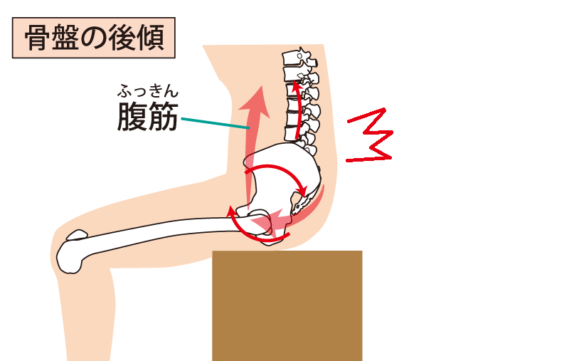 腰痛、ヘルニア、反り腰、ぎっくり腰の原因と根本治療。h&h八王子ユーロードの鍼灸整骨院・整体院