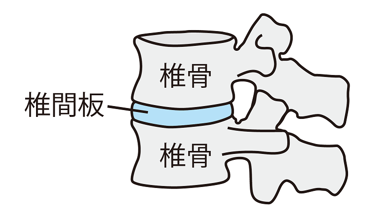 腰痛、ヘルニア、反り腰、ぎっくり腰の原因と根本治療。h&h八王子ユーロードの鍼灸整骨院・整体院