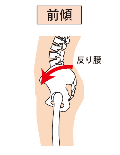 腰痛、ヘルニア、反り腰、ぎっくり腰の原因と根本治療。h&h八王子ユーロードの鍼灸整骨院・整体院