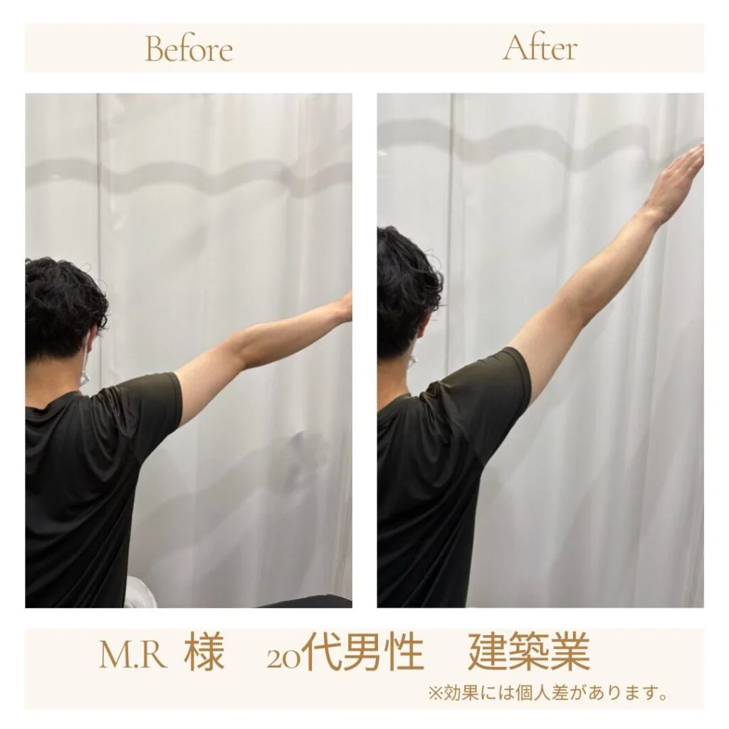 M.R様の施術前後の変化（腕を上げる動作）