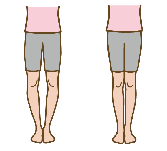 O脚・X脚の原因と改善方法。H&H八王子のパーソナル鍼灸整骨院・整体院