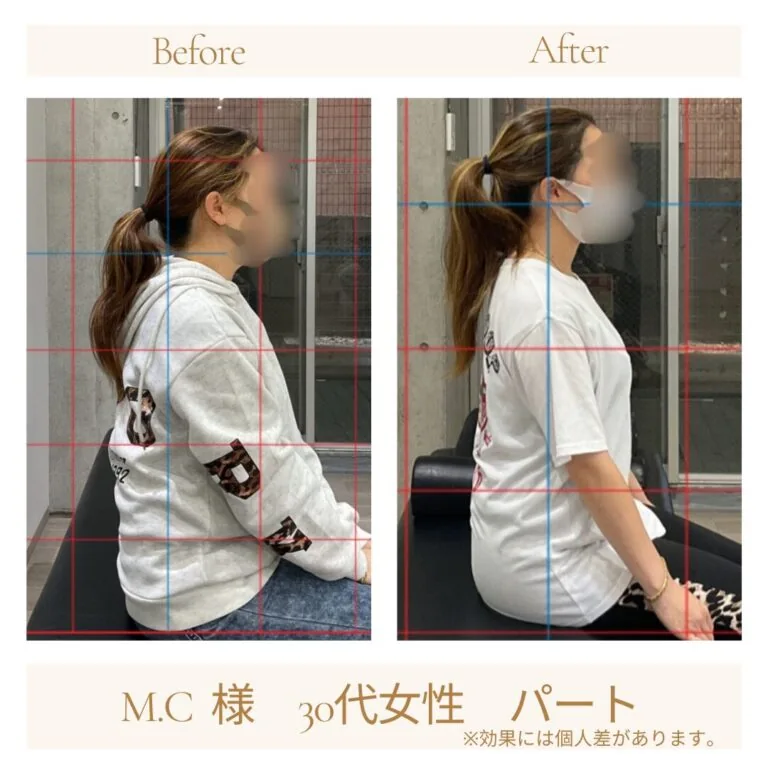 M.C様の施術前後の変化（座位姿勢）