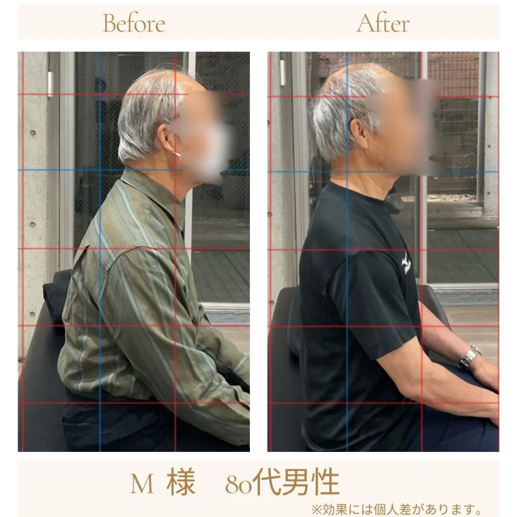 M様の施術前後の変化（座位姿勢）